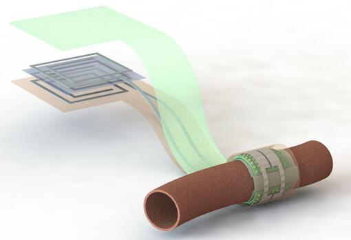 上圖描繪了這款可生物降解的壓力傳感器，它圍繞著一根血管，天線在左側(cè)(分離的層狀結(jié)構(gòu)，展示了天線結(jié)構(gòu)的細(xì)節(jié))